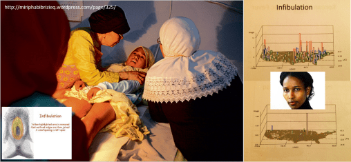 Infibulation_collage3