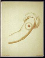 1798_JennersCowPoxProcedure