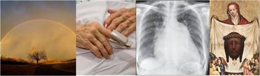 Miracles_stveronica_rheumheartdisease