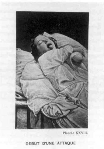 Psych_HysteroEpilepsieSalpetriere_DMBournevilleandPRegnard_Debutd'uneattack1867