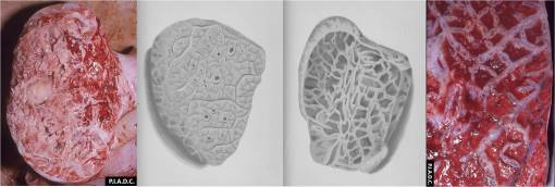 Pleuropneumonia_PIADC_BWIllustrations