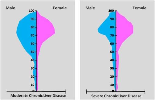 2ChronicLiverDiseases_Severe-Chronic