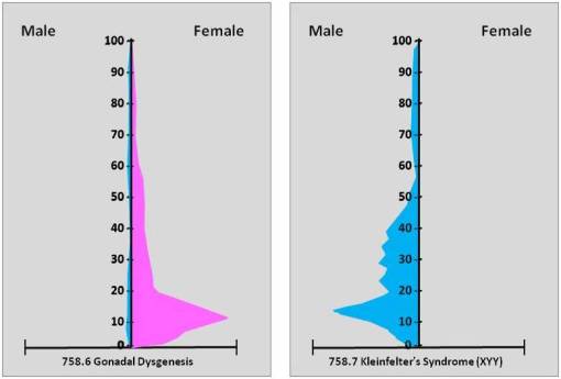GonadalDysgenesisKleinfelters