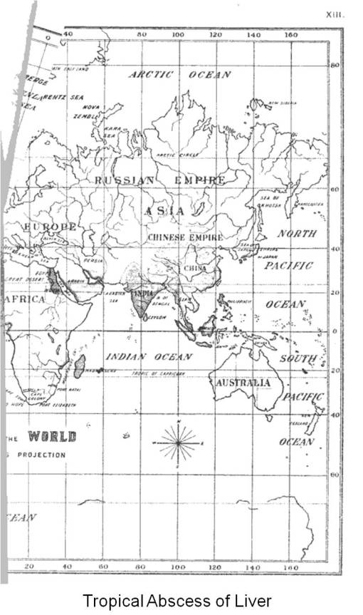 Felkin_1889_TropicalDiseases_45_TropicalAbscessofLiver_halfMAP