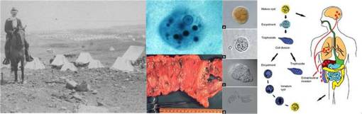 TropicalAmoebicDysentery