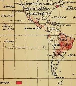 Felkin_07_Leprosy_SouthAmerica