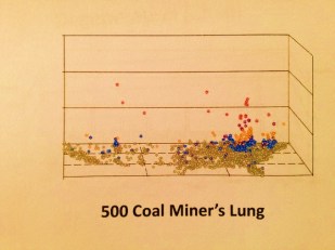 ColaMinersLung_Points