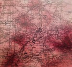 CarneysSeriesofMedicalCharts_1874_Phthisis_36-TheHub-Indianapolis-sm-contrasted