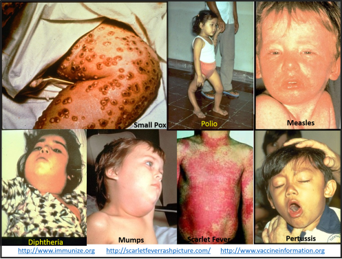 ChildhoodImmunizations